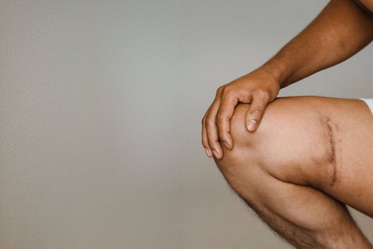 How Long Does It Take for Scars to Fade? A Realistic Timeline