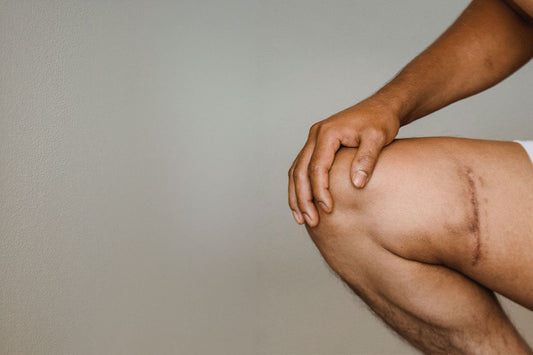 How Long Does It Take for Scars to Fade? A Realistic Timeline