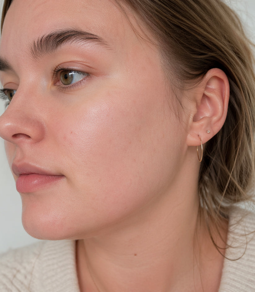 Restored skin barrier after Sting-Less Barrier Repair Cream treatment