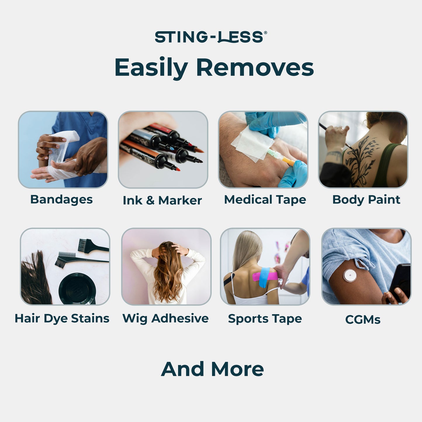 Sting-Less Adhesive Remover for Skin